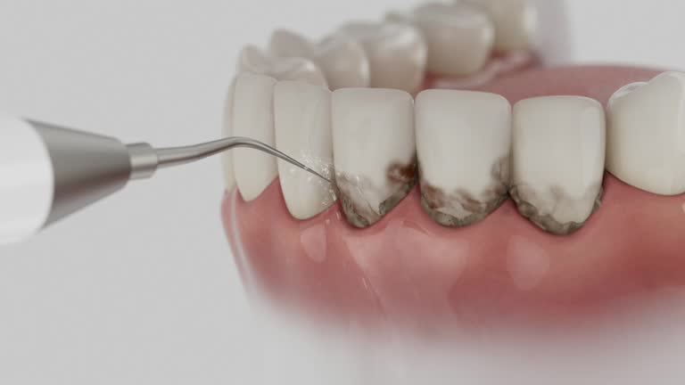 Trusted Teeth Cleaning And Checkup service in Douglasville, GA - Dentist Open Now